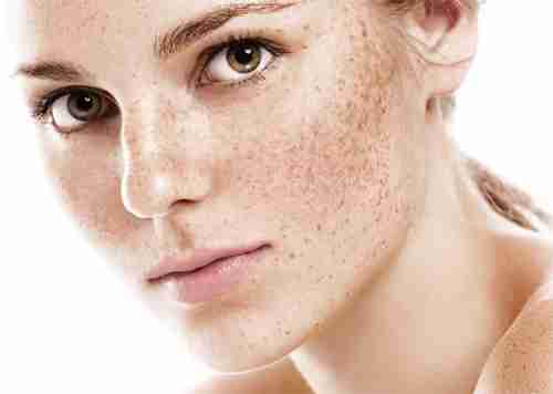 Pigmentation
