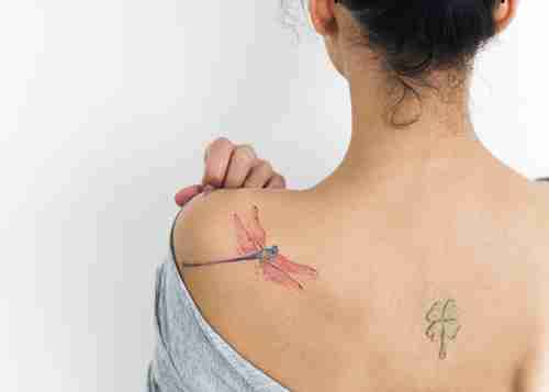Tattoo Removal