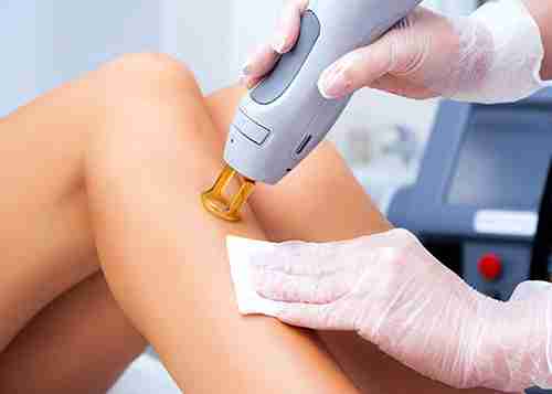 Hair Removal